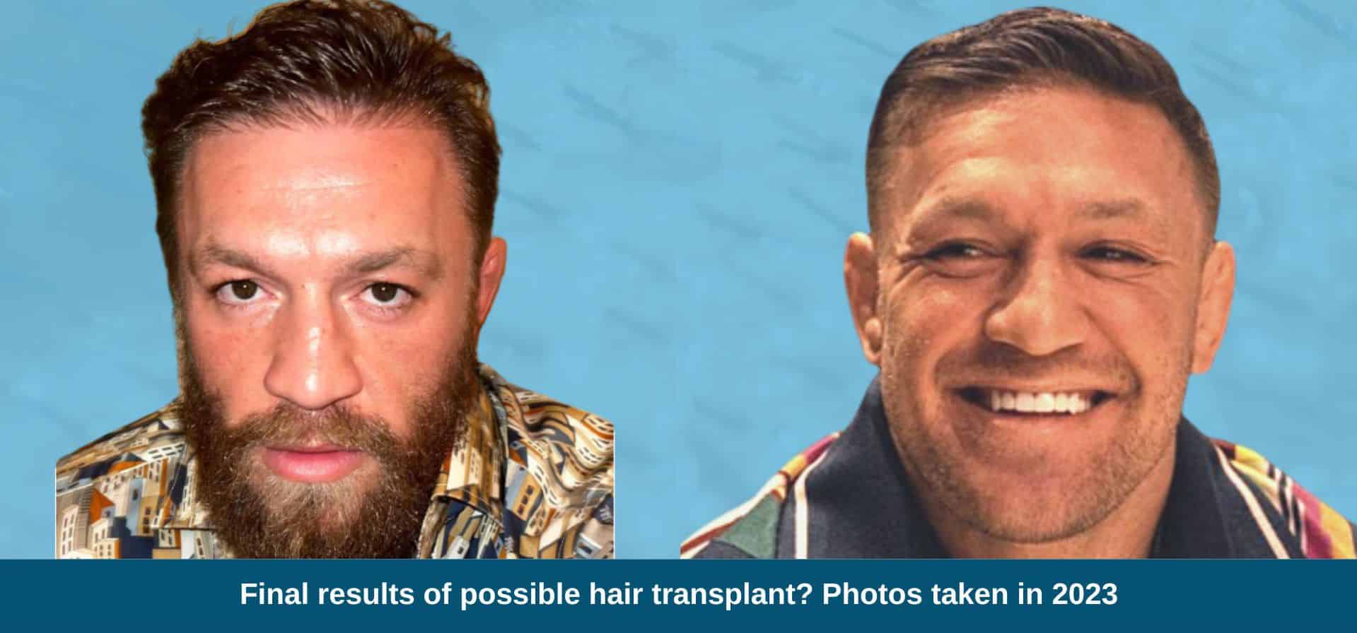 Analyzing Conor McGregor's Fox News Interviews: Key Takeaways Analyzing Conor McGregor's Fox News Interviews: Key Takeaways