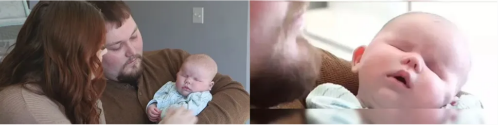 Bilateral Anophthalmia: Understanding This Rare Condition Affecting Babies Born Without Eyes Bilateral Anophthalmia: Understanding This Rare Condition Affecting Babies Born Without Eyes