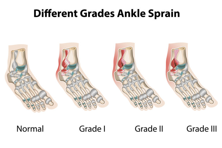 Brunson Expected Back Sunday: Ankle Sprain Recovery Complete