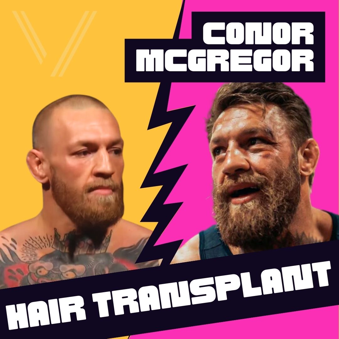 Conor McGregor's Fox News Appearance: Public Opinion Conor McGregor's Fox News Appearance: Public Opinion