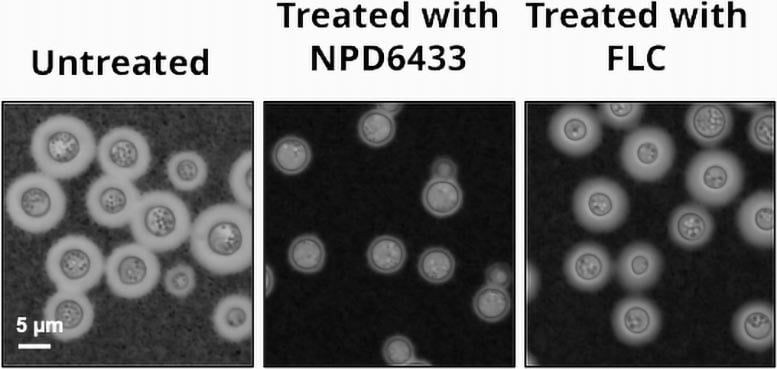 Deadly Fungi And The Urgent Need For New Antifungal Treatments Deadly Fungi And The Urgent Need For New Antifungal Treatments