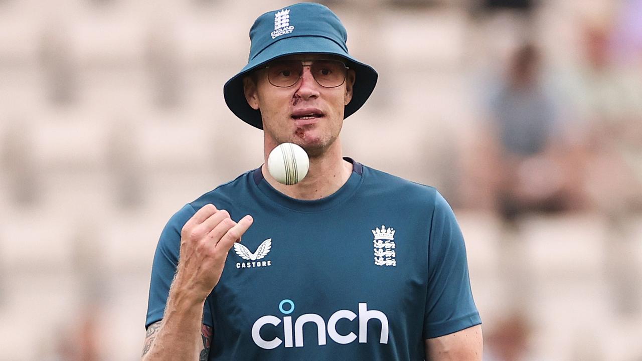 Flintoff Reveals Trauma Following Horrific Car Crash Flintoff Reveals Trauma Following Horrific Car Crash