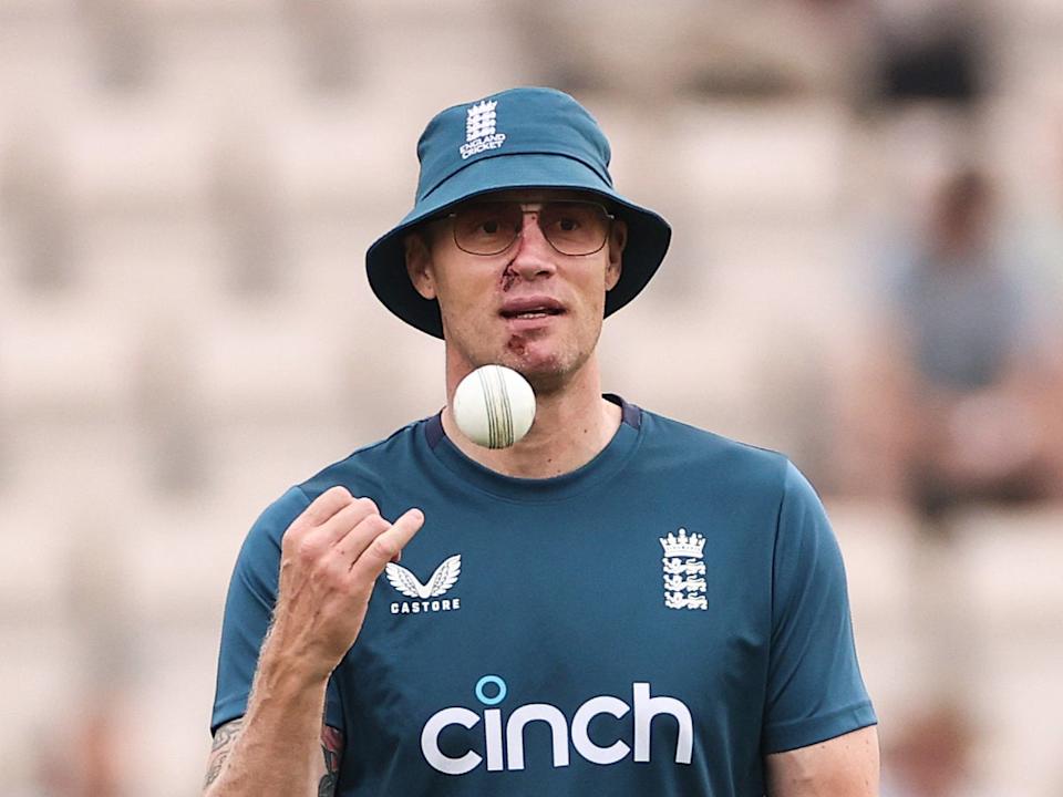 Freddie Flintoff's Recovery: PTSD, Facial Injuries, And New Beginnings Freddie Flintoff's Recovery: PTSD, Facial Injuries, And New Beginnings