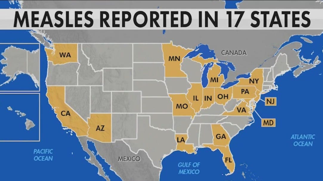 Measles In Kansas: Tracking The Recent Increase And Protecting Communities Measles In Kansas: Tracking The Recent Increase And Protecting Communities