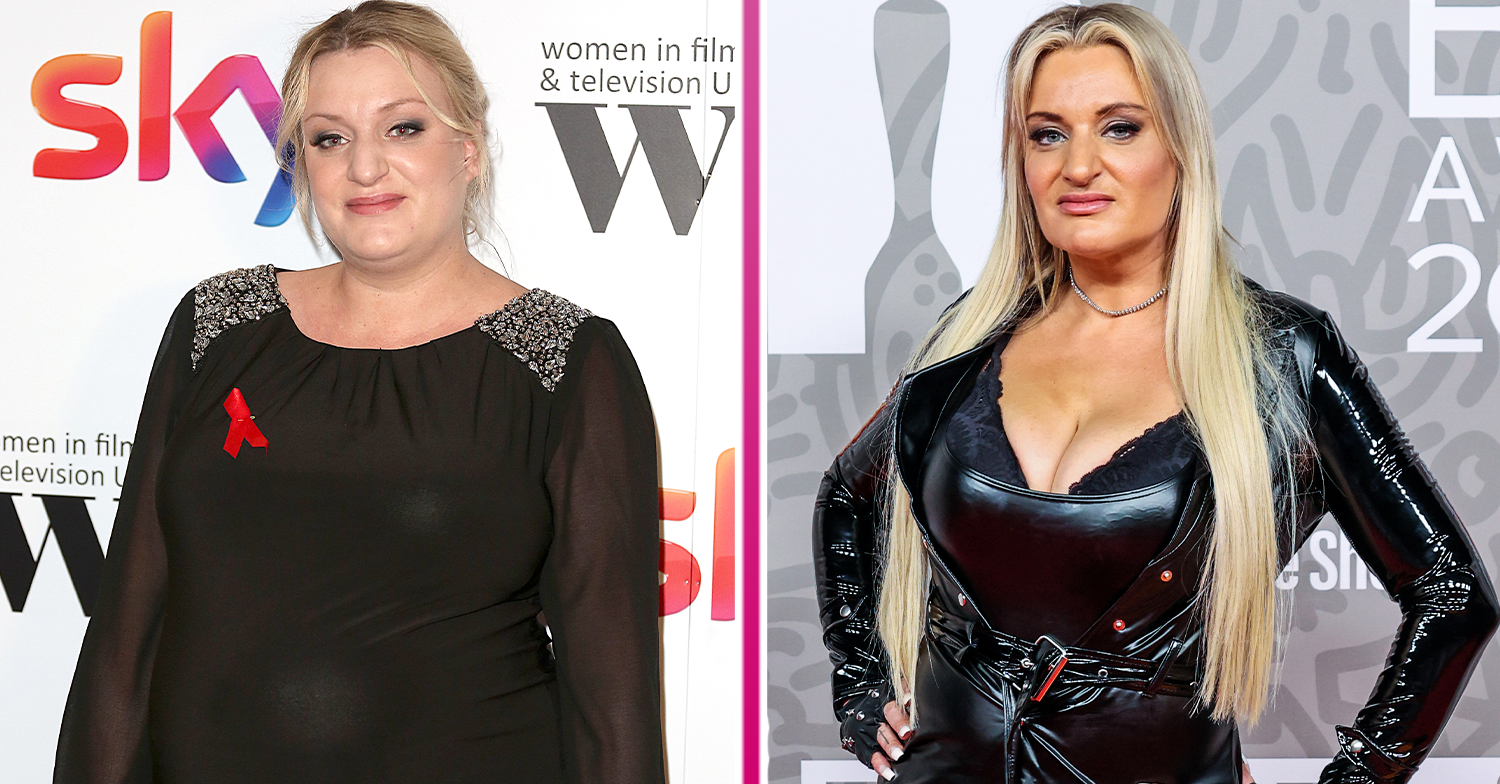 The Honest Truth: Daisy May Cooper Discusses Weight Loss And Lip Fillers The Honest Truth: Daisy May Cooper Discusses Weight Loss And Lip Fillers
